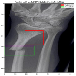 A graph of augmented training